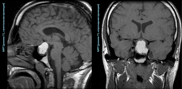 Гипофиз картинки красивые