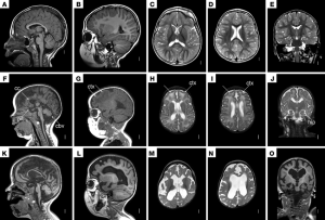 С какого возраста можно делать МРТ головного мозга ребенку?