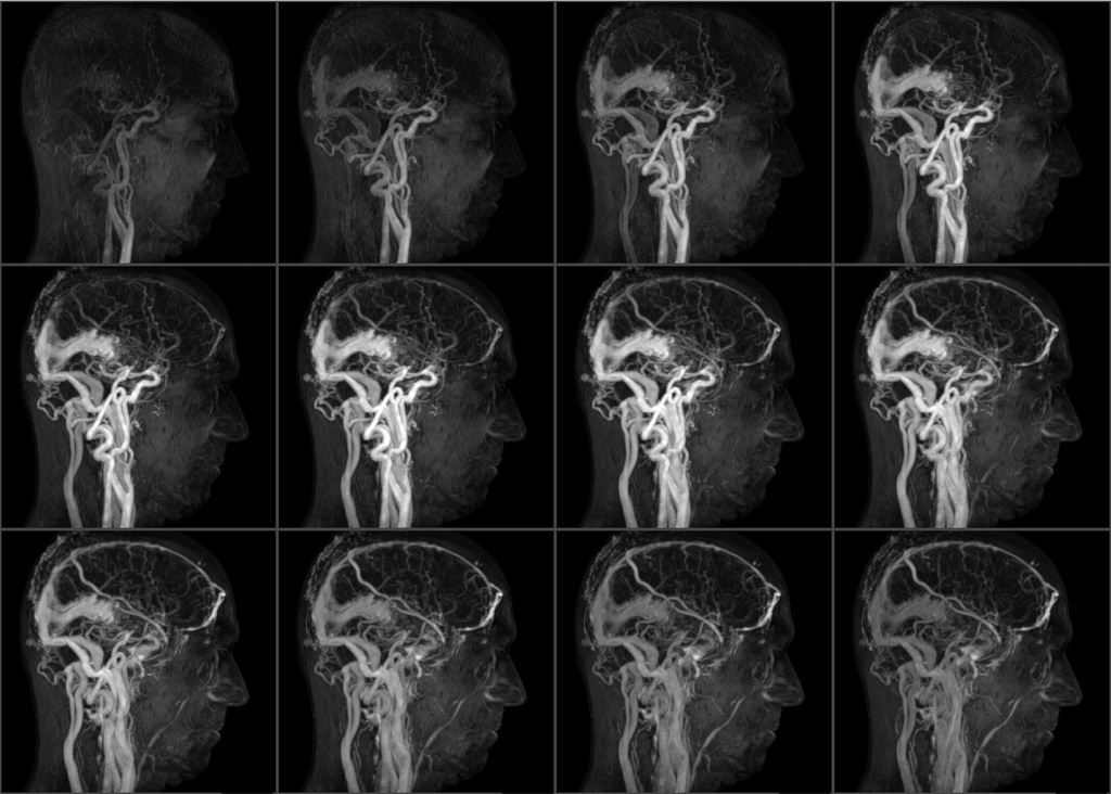 Как делают мрт головы и сосудов головного мозга взрослым фото до и после